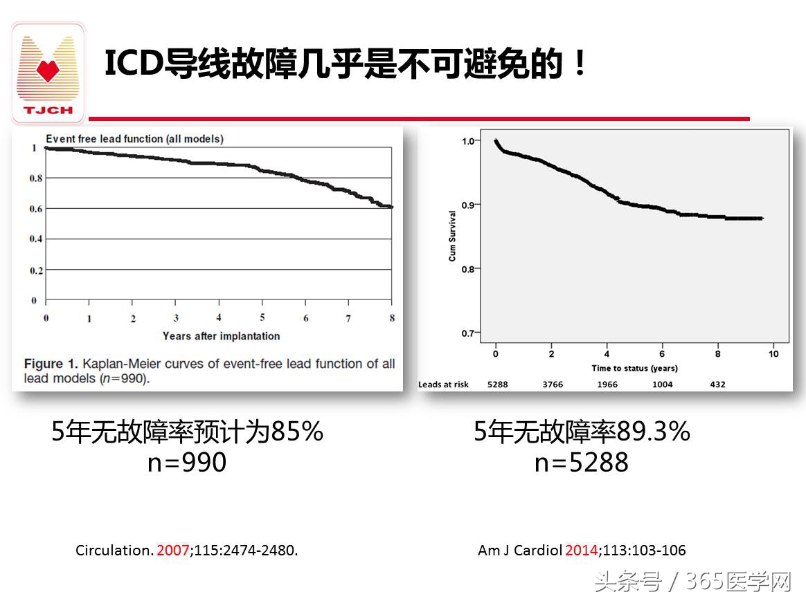许静：新技术避免ICD不恰当放电