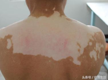 几元钱一瓶的药能治大病,一瓶才6粒的胃药