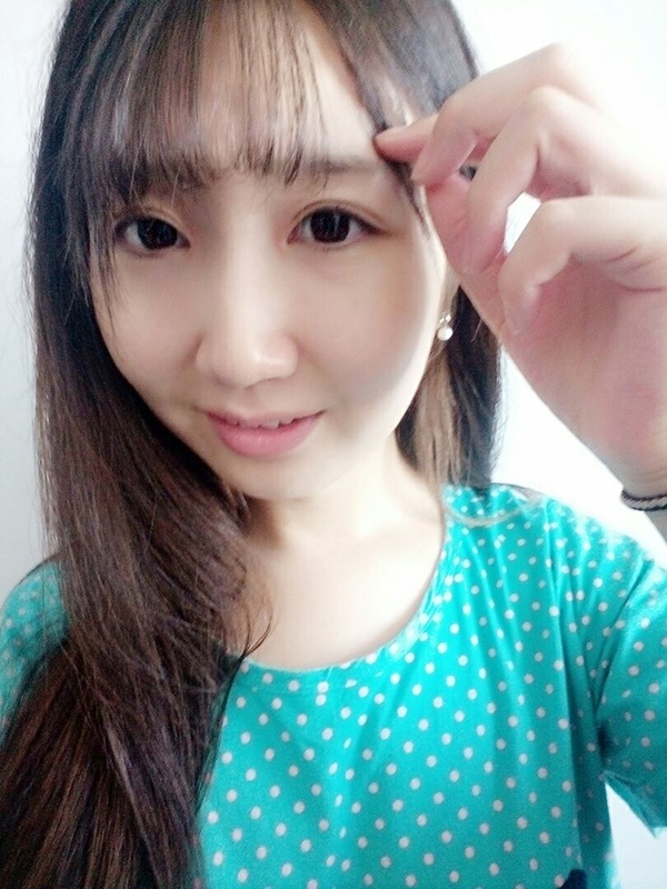 双眼皮全切手术恢复期,全切双眼皮恢复期眼尾分叉正常吗