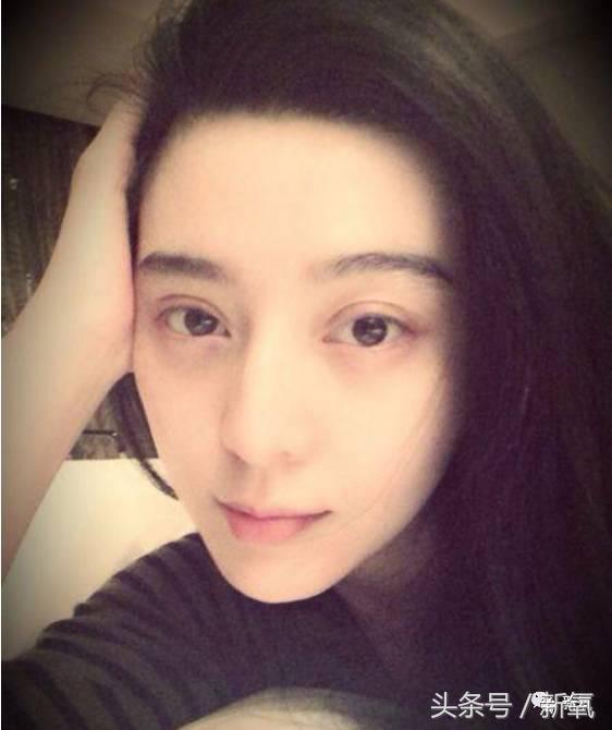 为什么开眼角会变漂亮,为什么开眼角很奇怪