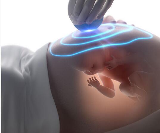 四维彩超能看出孩子是什么,四维彩超能看到小孩的五官吗