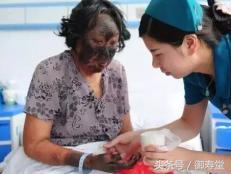 老人消肿止痛药,老人吃止痛药腿肿是什么原因