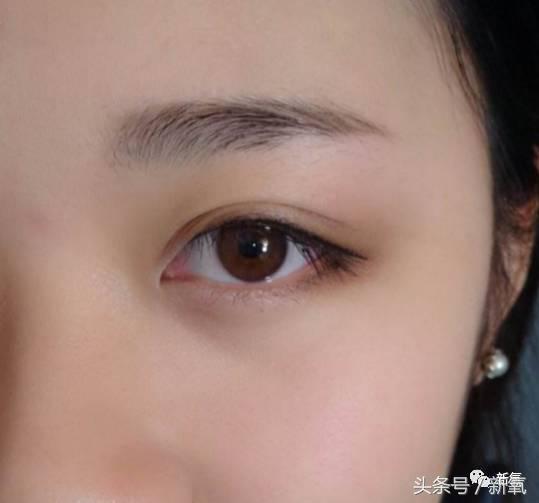 为什么开眼角会变漂亮,为什么开眼角很奇怪