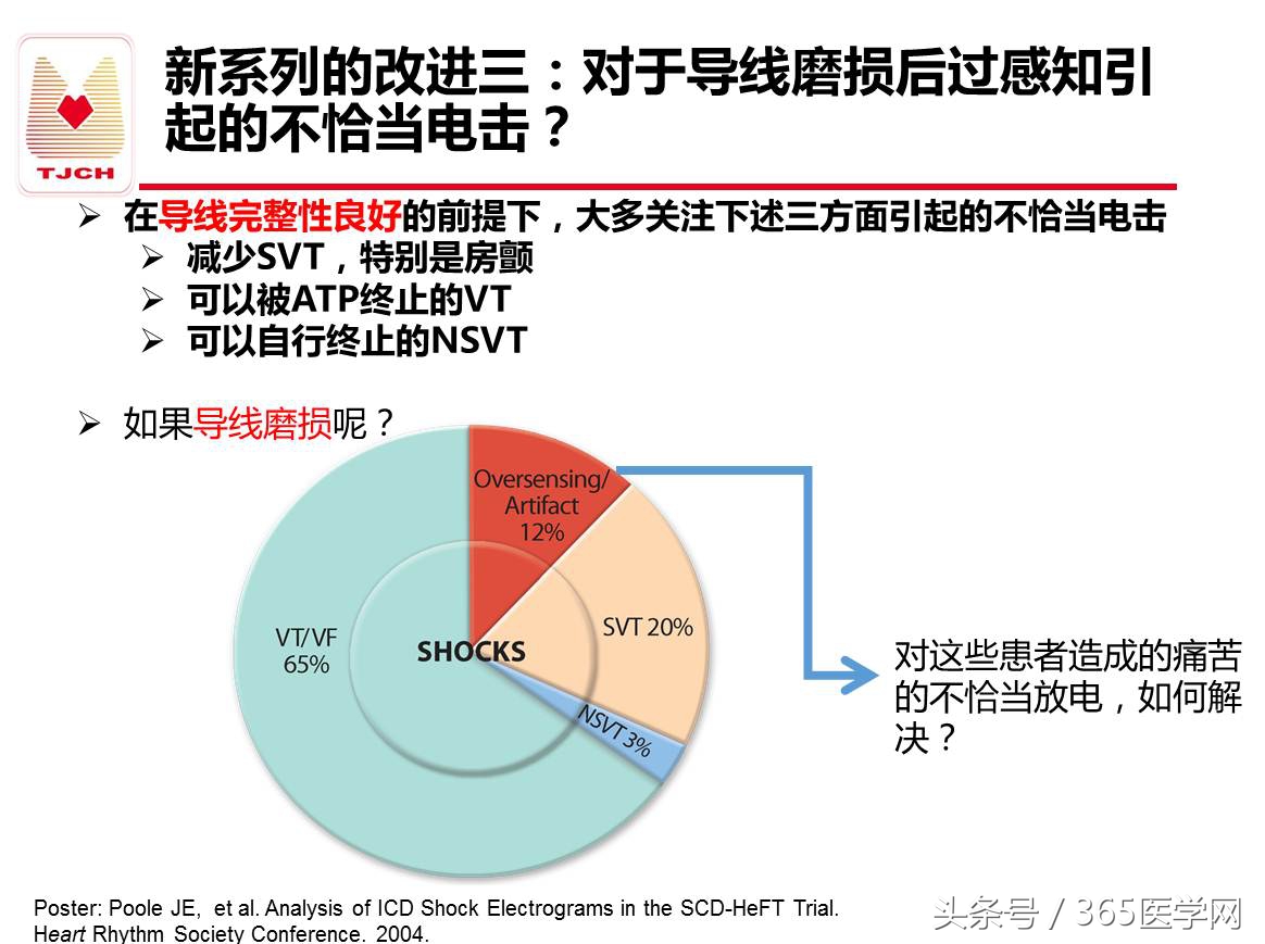 许静：新技术避免ICD不恰当放电