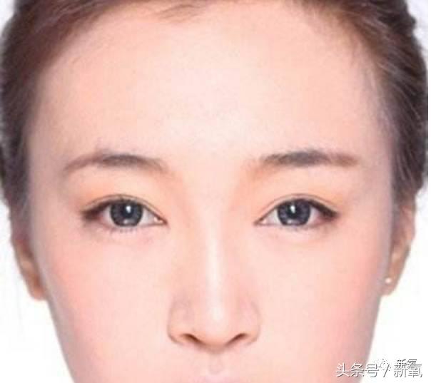 为什么开眼角会变漂亮,为什么开眼角很奇怪
