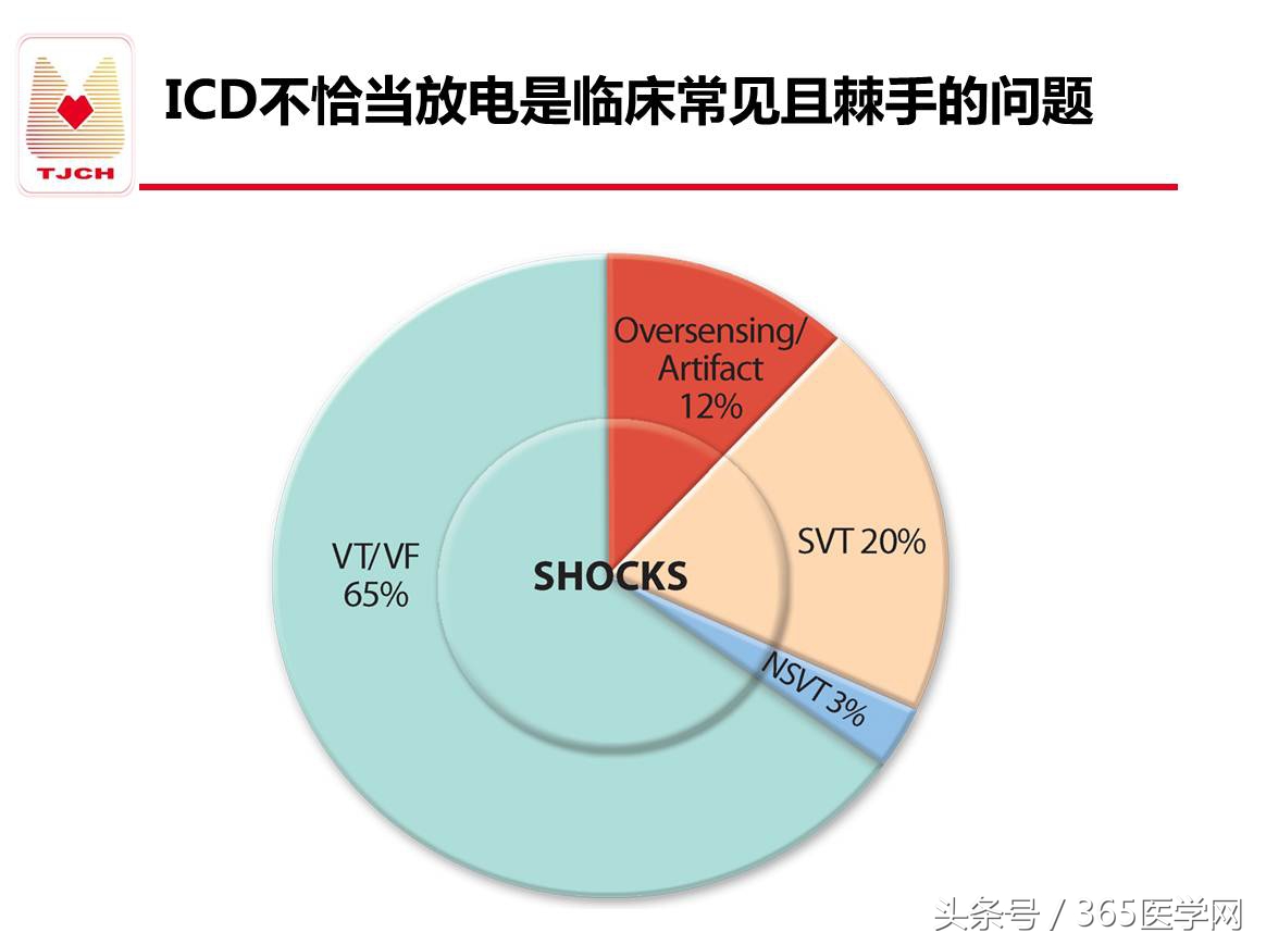 许静：新技术避免ICD不恰当放电