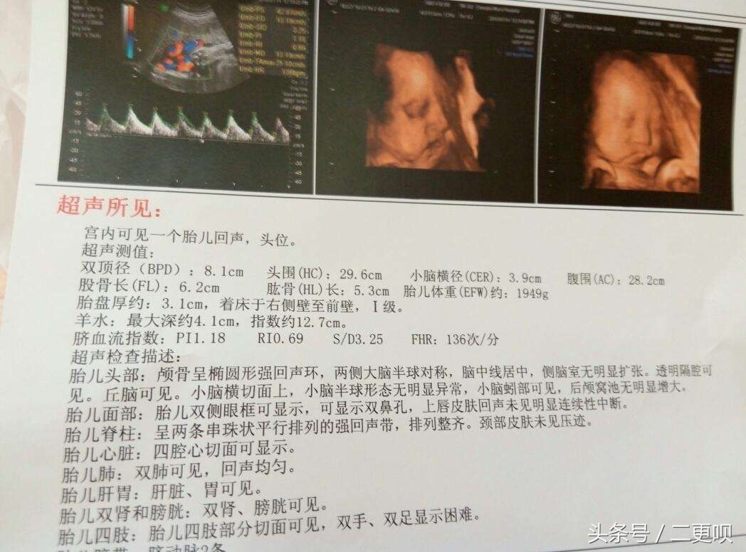 做四维被医生说胖,怀孕做四维肚皮厚做不了