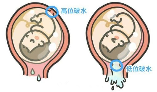 医生诊断错了怎么办,医生你是不是弄错了