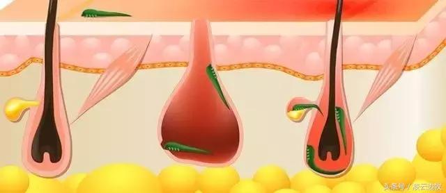 狗狗耳朵上有螨虫图,狗狗螨虫去除全过程