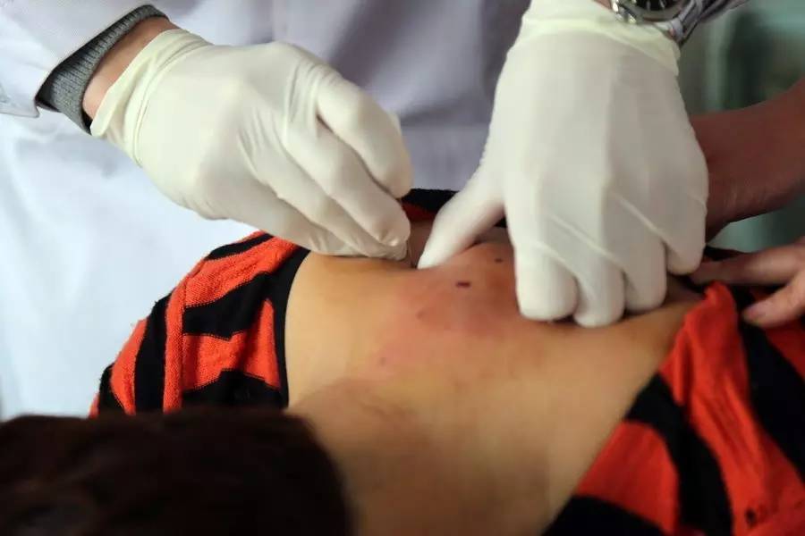 基层医院疼痛科,基层诊所疼痛科