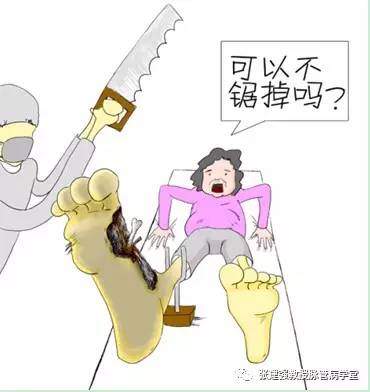 糖尿病足溃疡治疗方法,糖尿病足慢性溃疡修复术