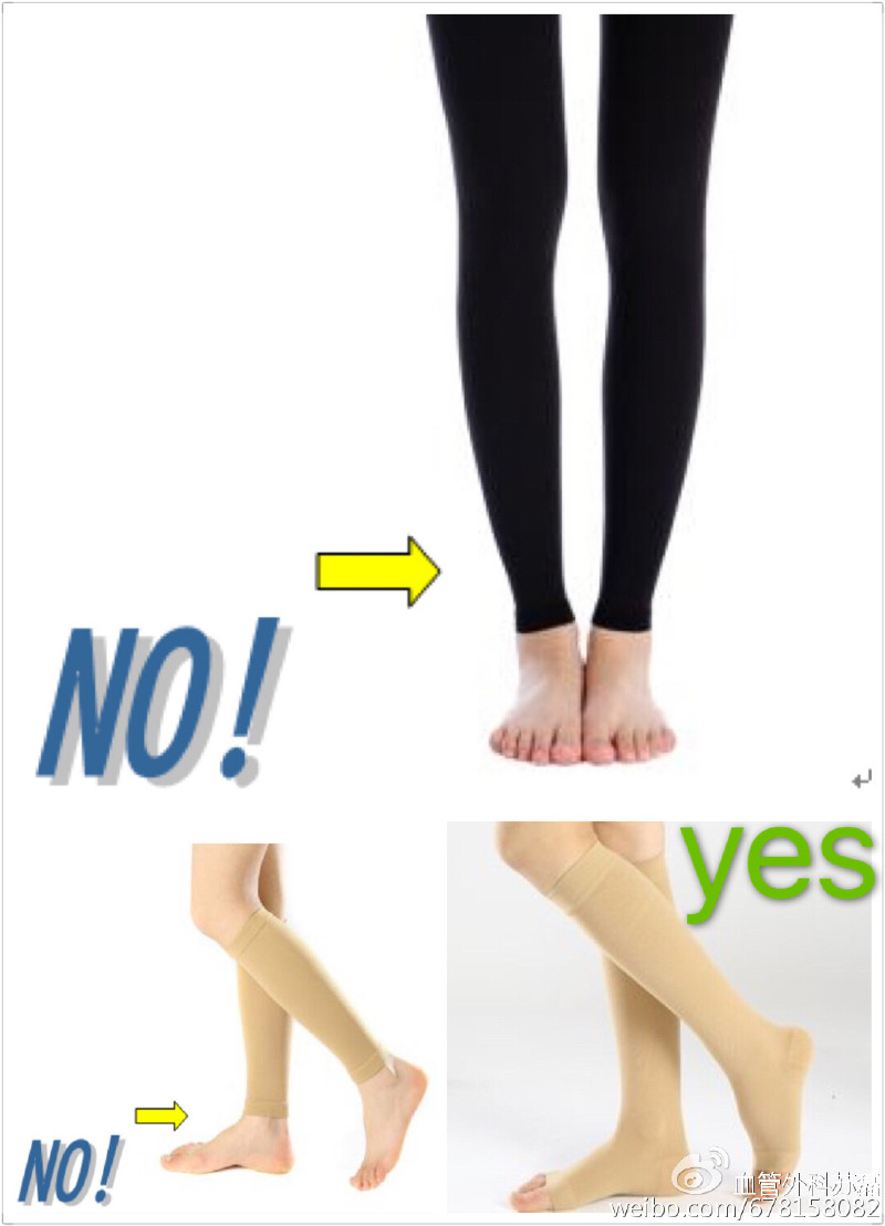 静脉曲张引发溃疡怎么治疗,如何治疗静脉曲张引起的溃疡