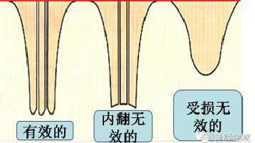 涨姿势：母猪乳腺内部结构详解