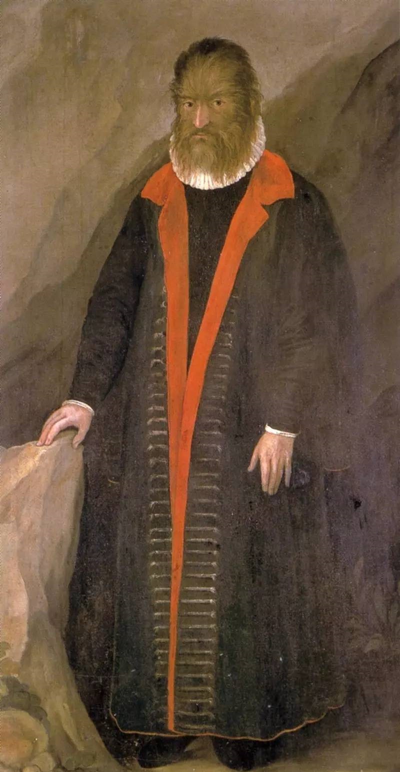 美女与野兽确有其人？