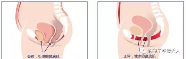 准妈妈健身,有助顺产无侧切的动作