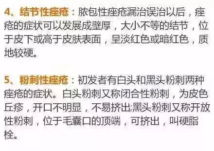 挤痘痘出来的白色东西很臭,挤痘痘出来的白色东西是什么