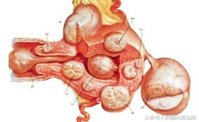 肉瘤的中医辨证论治,中医辨证治疗腹膜后纤维肉瘤