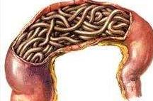 准妈妈实用技能：如何判断宝宝得了蛔虫病附治疗方式