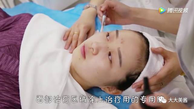 视频｜还没到30，皮肤松弛了？不开刀也不疼的射频提升？