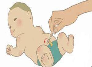 护理好新生儿的脐带残端