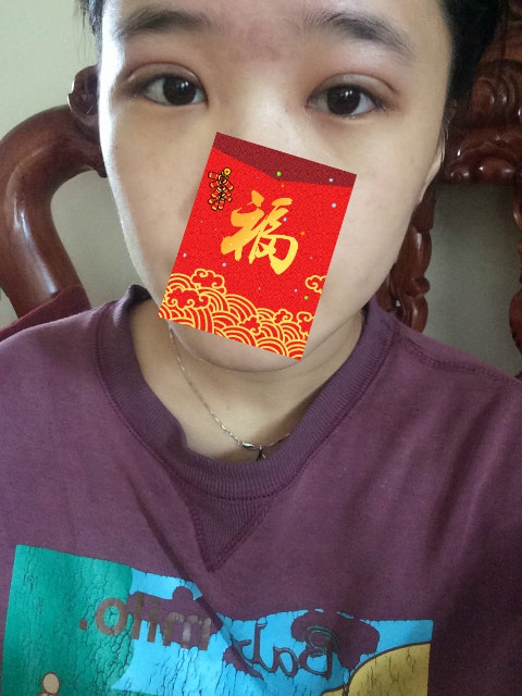 全切双眼皮20天了还一大一小,全切双眼皮的第二个月不来大姨妈