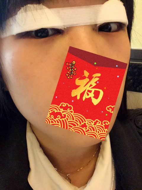 全切双眼皮20天了还一大一小,全切双眼皮的第二个月不来大姨妈