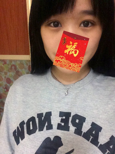 全切双眼皮20天了还一大一小,全切双眼皮的第二个月不来大姨妈