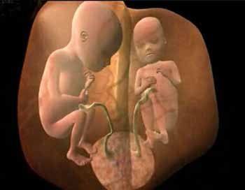 双胎妈妈做无创有必要做唐筛吗,双胞胎的妈妈为什么不能生二胎