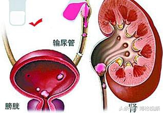 青年尿频自愈的最佳方法,35岁男性经常尿频尿急怎么回事