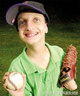 色素沉着会患白癜风吗,手上长白斑一定是白癜风吗