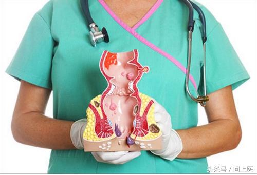 痔疮不管它有什么后果,痔疮患者需要了解的事