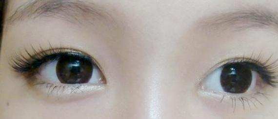 卧蚕与眼袋别傻傻分不清楚,卧蚕眼袋黑眼圈傻傻分不清楚