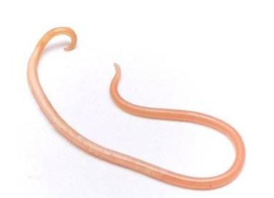 准妈妈实用技能：如何判断宝宝得了蛔虫病附治疗方式