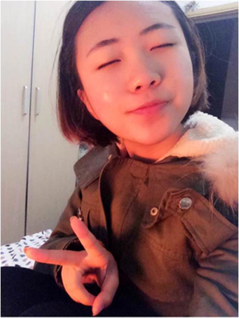 长痘痘黑头粉刺关注什么,青春期脸上长痘痘饮食关注什么