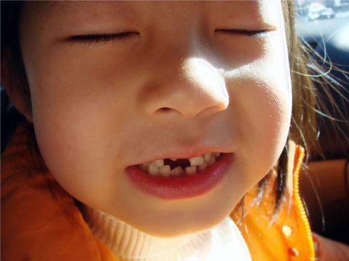乳牙龋齿该换牙了却迟迟没动静,孩子换牙乳牙不掉新牙长歪怎么办