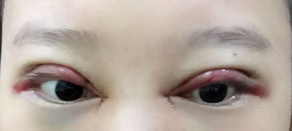 不认识的人看到我，完全看不出来做过双眼皮