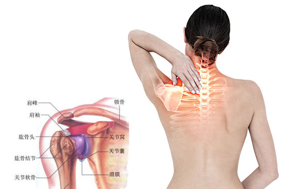 肩膀疼痛肩周炎怎么治疗,肩周炎肩膀疼最快的治疗方法
