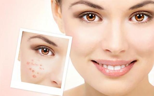 换季疯狂长痘为什么,为什么一到换季皮肤就长痒痘