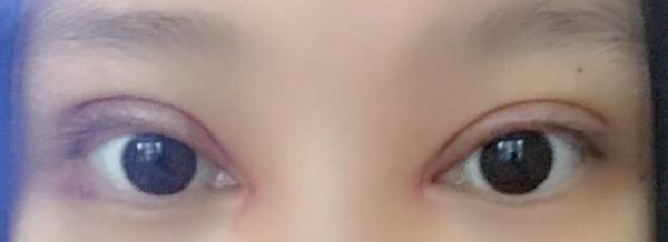 不认识的人看到我，完全看不出来做过双眼皮