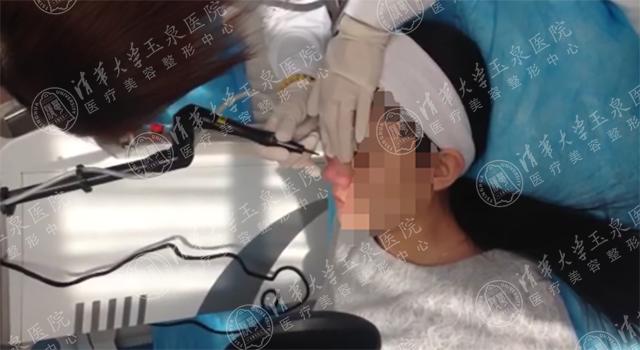 换季疯狂长痘为什么,为什么一到换季皮肤就长痒痘