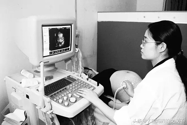 做四维彩超需要空腹吗？报考单怎么看性别？