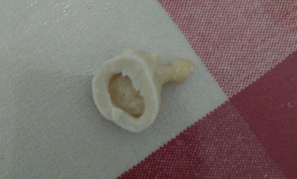 奶粉选择哪一款比较适合,什么奶粉好教你选择最合适的一款