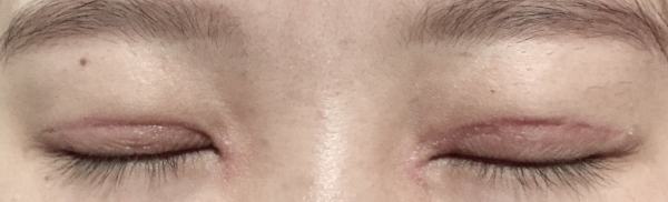 不认识的人看到我，完全看不出来做过双眼皮