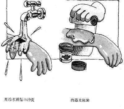 一岁多宝宝烫伤用什么中药,一岁宝宝稀饭烫伤