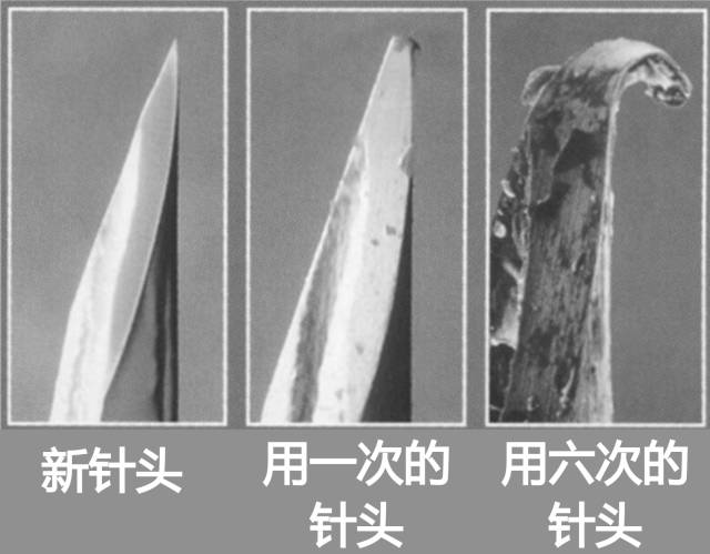 胰岛素注射疼痛如何解决,打完胰岛素全身疼痛怎么回事