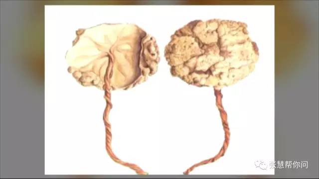 拔剑泉边洗“胎盘”，老人称购自医院！“人肉”补品靠谱吗？