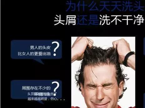 头皮屑到底是什么啊,原来头皮屑是怎么来的