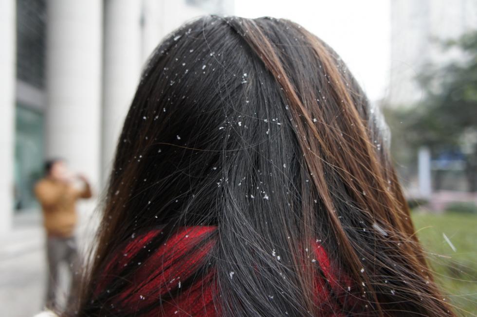 头皮屑到底是什么啊,原来头皮屑是怎么来的