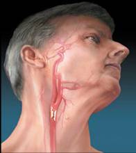 改善脑供血不足的药有哪些,脑供血不足常敲打3个穴位