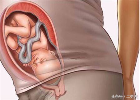 孕晚期胃不舒服怎么锻炼,孕晚期感觉胃部不适怎样缓解